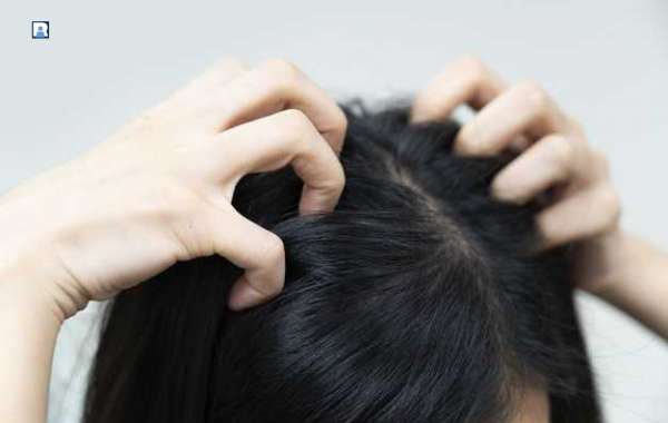 How to Take Care of Hair in Winter Naturally